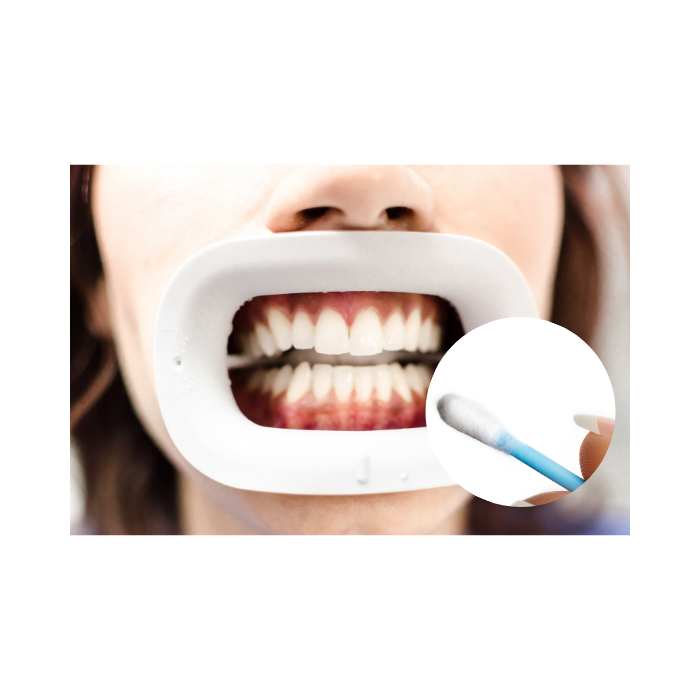 歯についてる水分をふき取り、ハケで縦方向に溶液を塗ります。